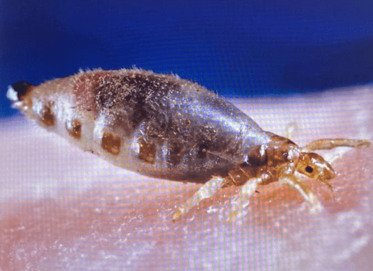 уничтожение вшей